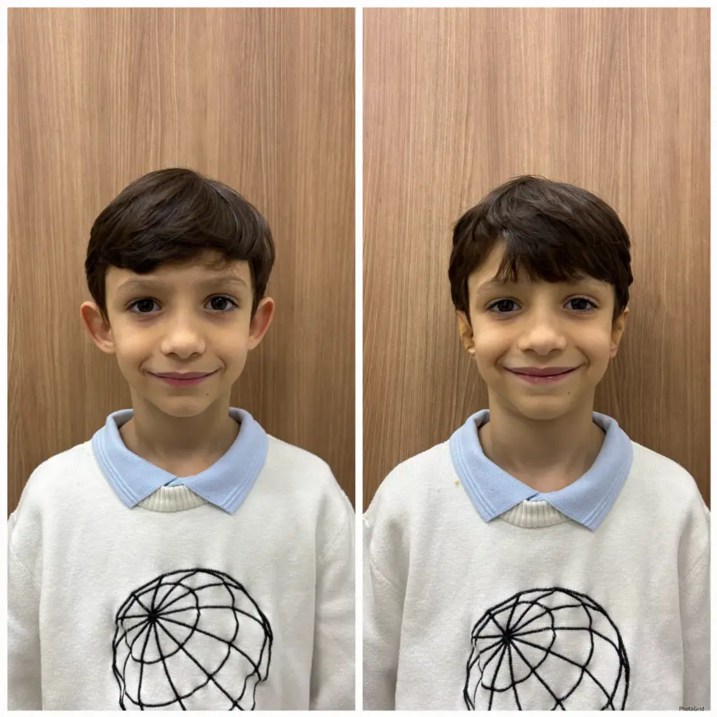 correção de orelhas com especialista