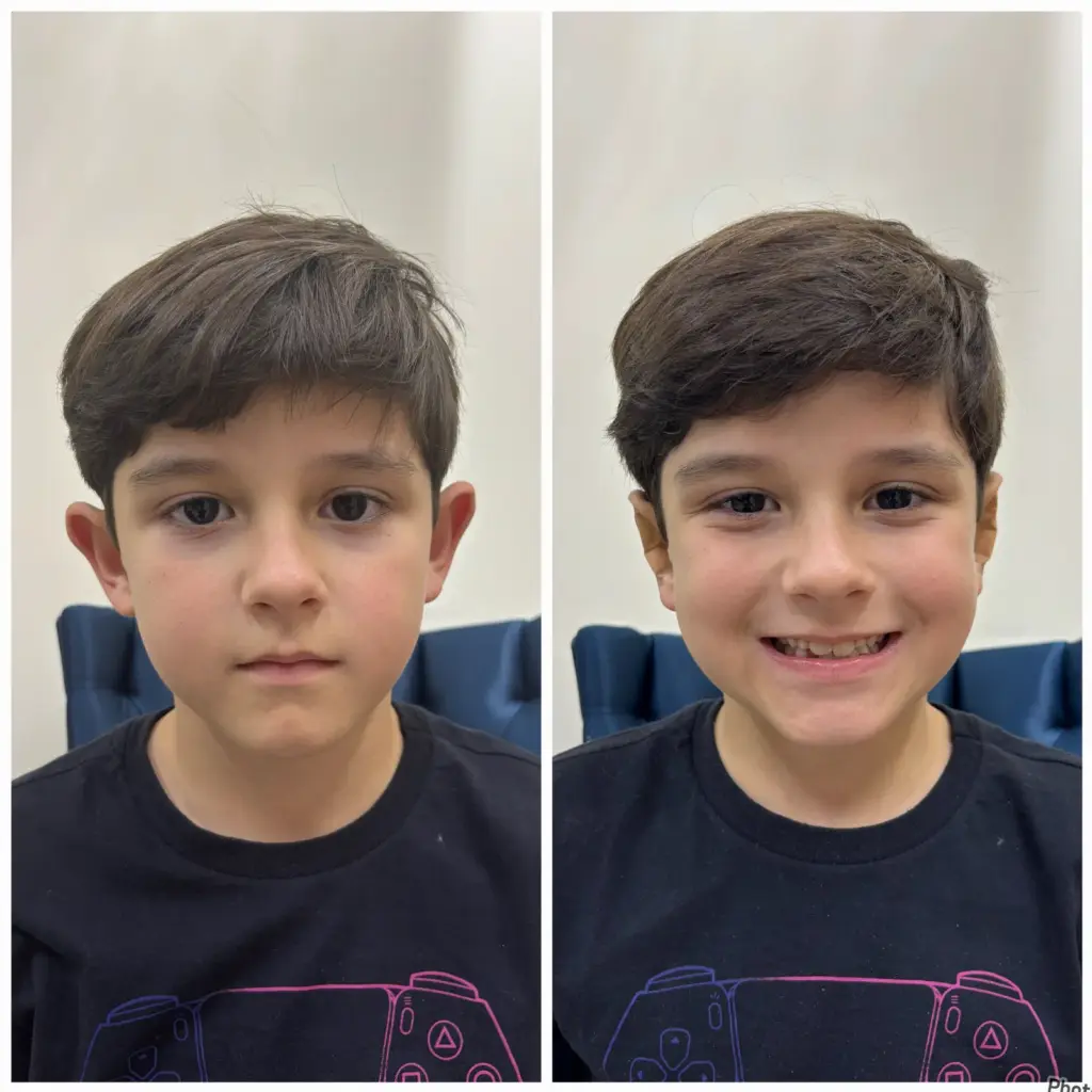 correção de orelhas com especialista