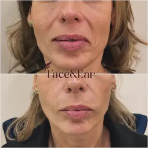 tratamento estético facial